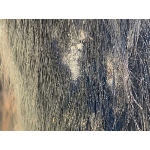 Shampoo Prävention und Pflege TEA TREE 500ml